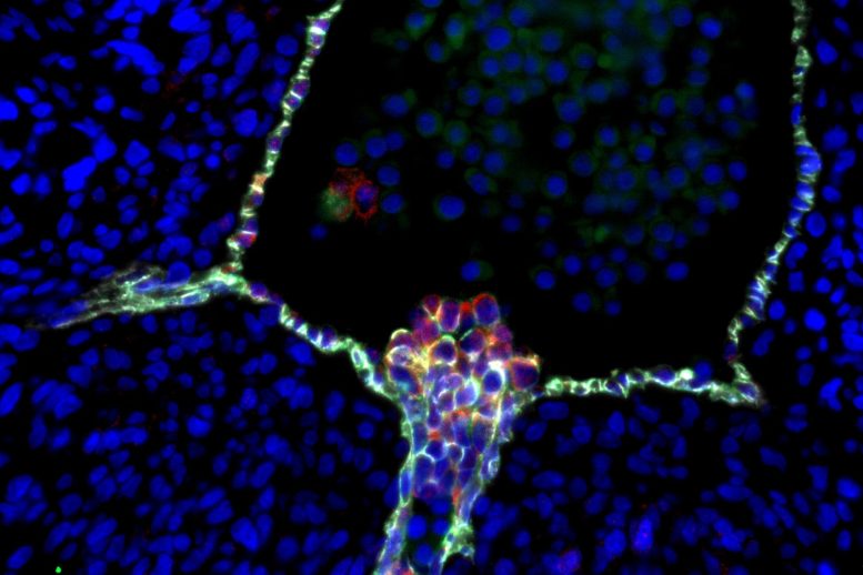 科学家们创建了人类血液干细胞发育的第一个全景图像