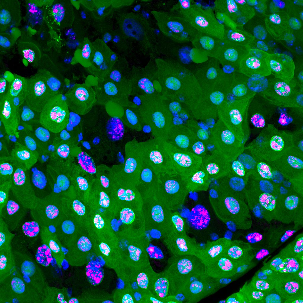 黑暗中的死亡：在苍蝇胆中发现的一种新型细胞死亡机制
