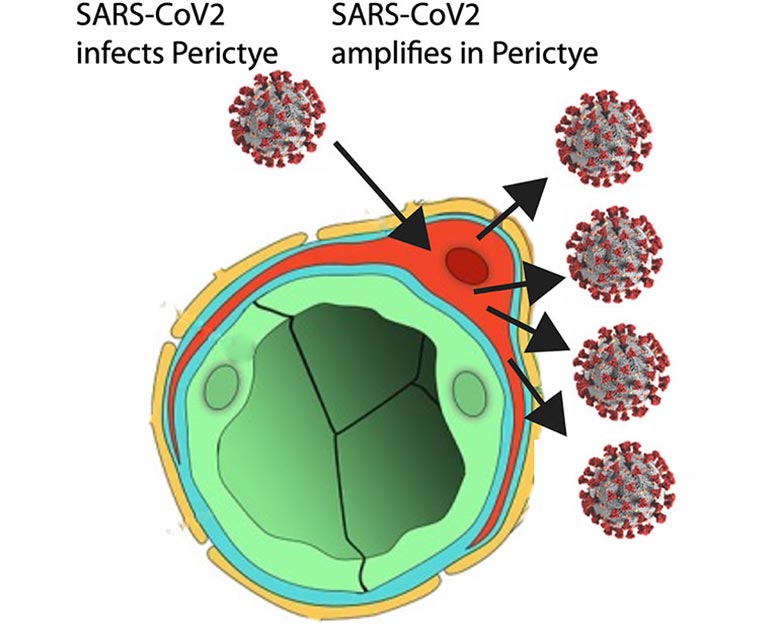 SARS-CoV-2 通过血管传播